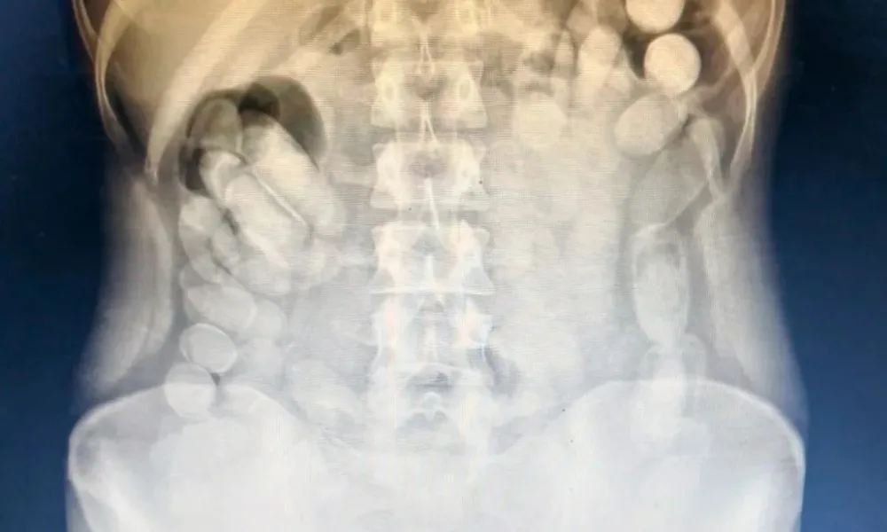 Radiografía de la mujer