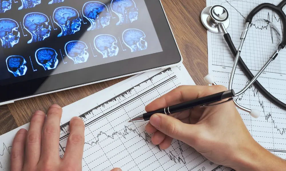 Esclerosis múltiple